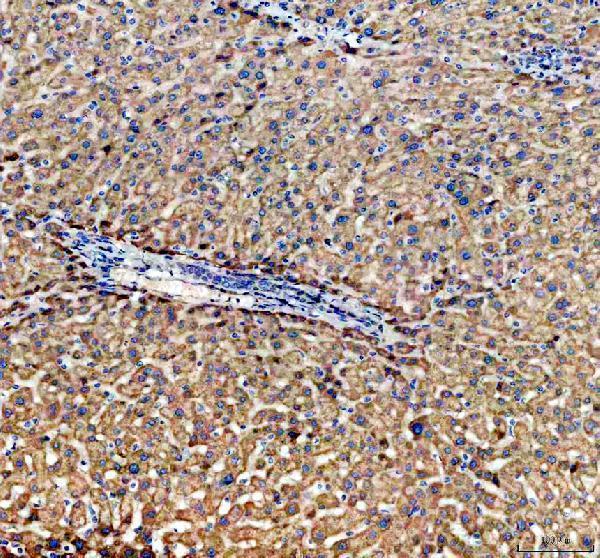 IHC analysis of ABCG5 using anti-ABCG5 antibody (A01503-2)