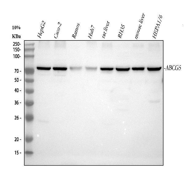 Western blot analysis of ABCG5 using anti-ABCG5 antibody (A01503-2)
