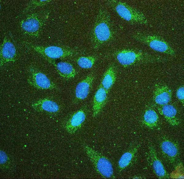 a01504 1 hk1 primary antibodies if testing 6