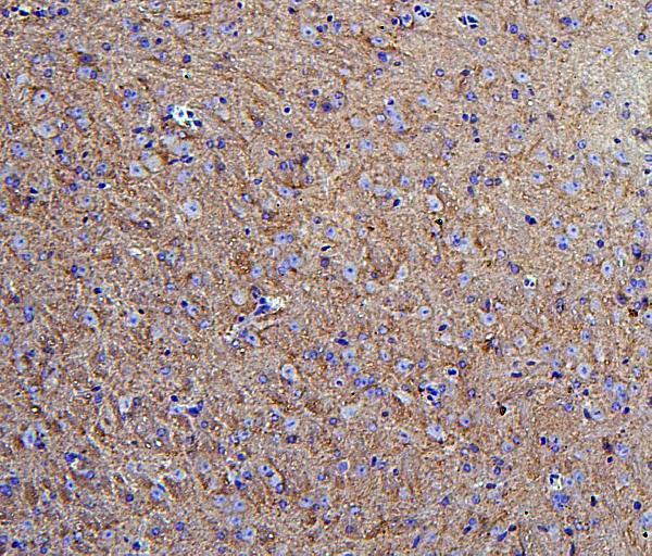  IHC analysis of Hexokinase 1/HK1 using anti-Hexokinase 1/HK1 antibody (A01504-1)