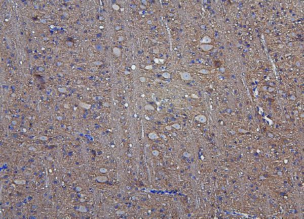  IHC analysis of Hexokinase 1/HK1 using anti-Hexokinase 1/HK1 antibody (A01504-1)