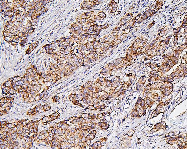 a01504 1 hk1 primary antibodies ihc testing 4