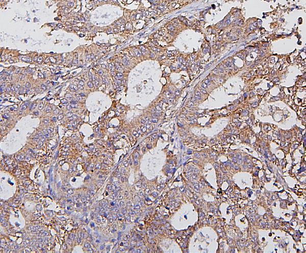 a01504 1 hk1 primary antibodies ihc testing 5