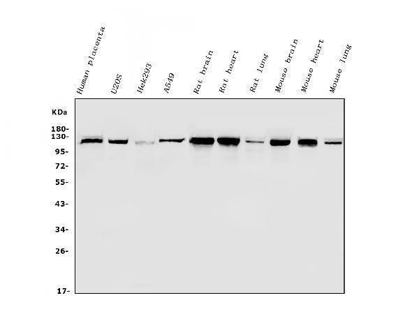  Western blot analysis of Hexokinase 1/HK1 using anti-Hexokinase 1/HK1 antibody (A01504-1)