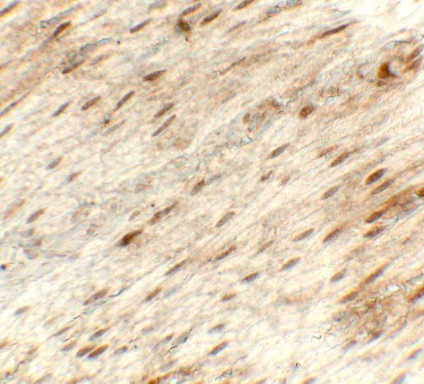 Immunohistochemistry of Hexokinase 1 in rat stomach tissue with Hexokinase 1 antibody at 5 μg/mL