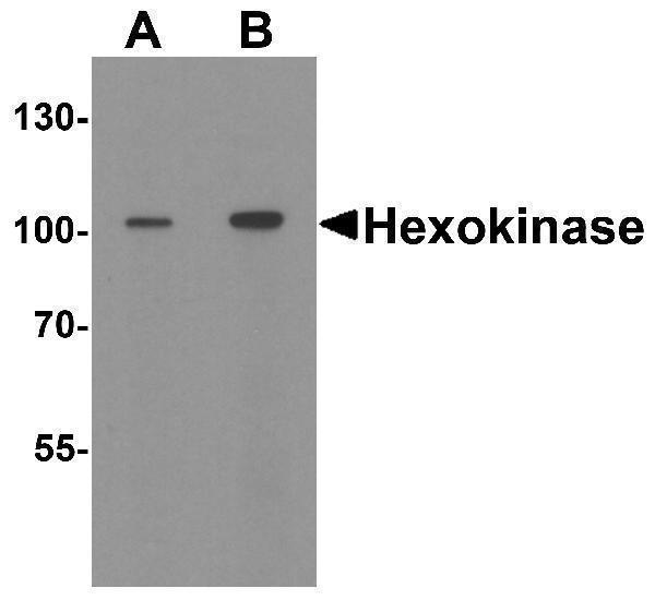 Western blot analysis of Hexokinase 1 in rat bladder tissue lysate with Hexokinase 1 antibody at (A) 1 and (B) 2 μg/ml