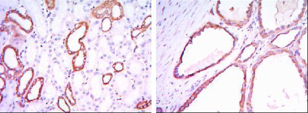 Immunohistochemistry analysis of paraffin-embedded kidney tissues with DAB staining using HXK I Monoclonal Antibody