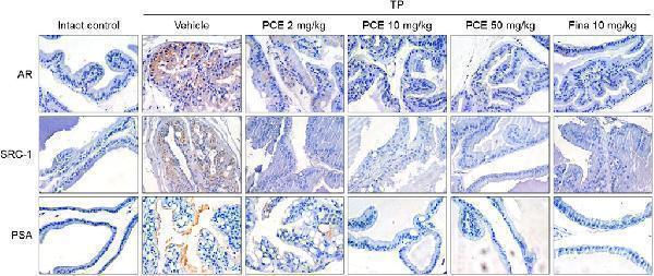 Effect of PCE on AR signaling-related protein expression in rats with TP-induced BPH