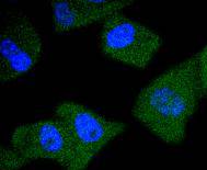 ICC staining PSA in PC-3M cells (green)