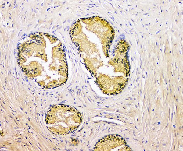 a01505 3 klk3 primary antibodies ihc testing 2