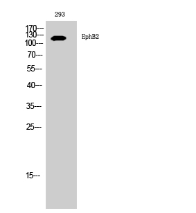a01507 2 ephb2 primary antibodyes wb testing 1