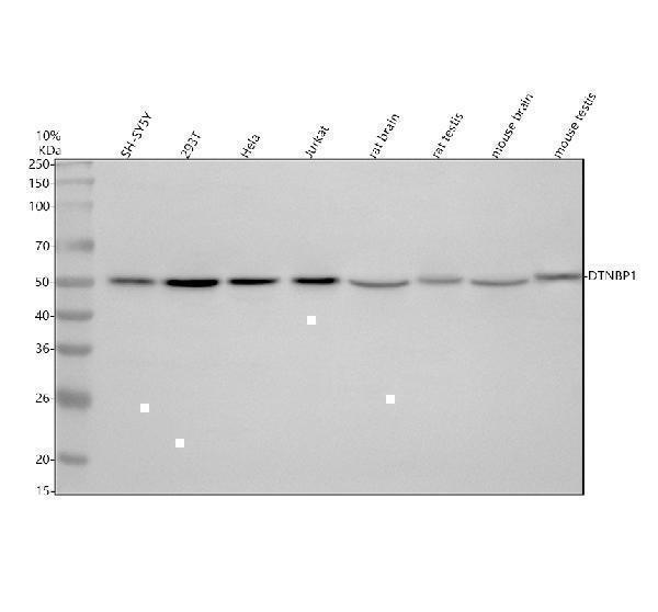  Western blot analysis of Dysbindin/DTNBP1 using anti-Dysbindin/DTNBP1 antibody (A01509-1)