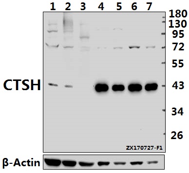 Western blot (WB) analysis of Cathepsin H polyclonal antibody at 1:500 dilution
Lane1:CT26 whole cell lysate(40ug)
Lane2:PC12 whole cell lysate(40ug)
Lane3:AML-12 whole cell lysate(40ug)
Lane4:PC3 whole cell lysate(10ug)
Lane5:HepG2 whole cell lysate(10ug)
Lane6:A549 whole cell lysate(10ug)
Lane7:MCF-7 whole cell lysate(10ug)