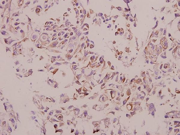 a01510y205 ctsh primary antiboties ihc testing 2