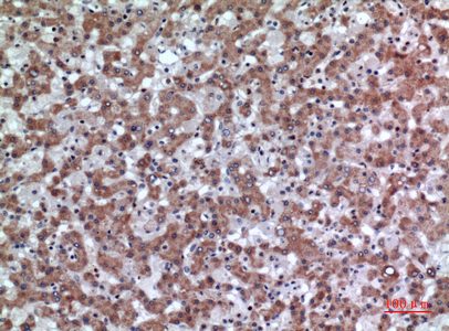 Immunohistochemical analysis of paraffin-embedded human-liver, antibody was diluted at 1:100