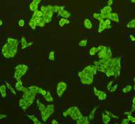 ICC staining CD31 in Hela cells (green)