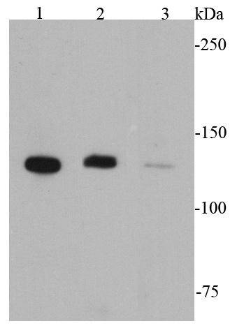 Western blot analysis of CD31 on different cell lysates using anti-CD31 antibody at 1/1000 dilution