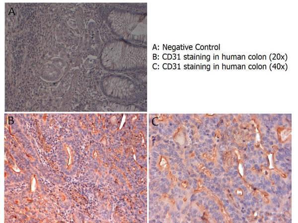 Immunohistochemistry with anti-CD31 antibody showing CD31 staining of vascular endothelium in human colon at 20x and 40x (B & C)