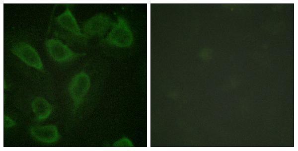 Immunofluorescence analysis of HeLa cells, using PECAM-1 (Phospho-Tyr713) Antibody