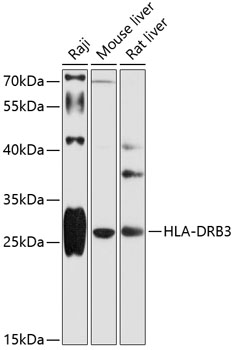 Western blot analysis of extracts of various cell lines, using HLA-DRB3 antibody  at 1:1000 dilution
