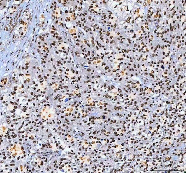 a01515 3 ahrr primary antibodies ihc testing 2