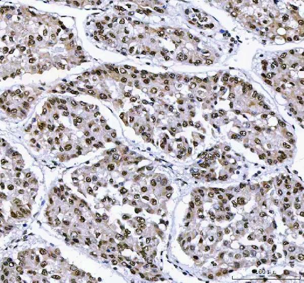 a01515 3 ahrr primary antibodies ihc testing 5