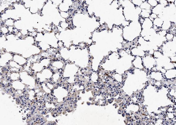 a01516 1 ncr1 primary antibodies ihc testing 4