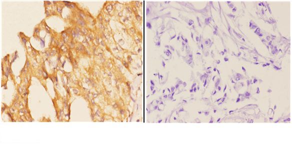 a01517 1 pik3cg primary antiboties ihc testing 2