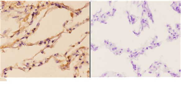 a01517 1 pik3cg primary antiboties ihc testing 3
