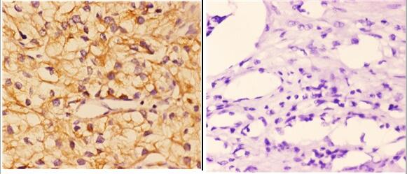 a01517 1 pik3cg primary antiboties ihc testing 4