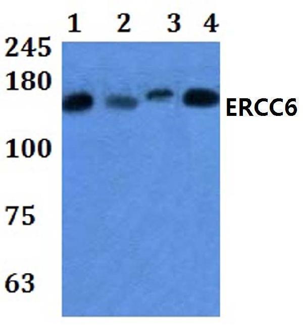 a01519 ercc6 primary antiboties wb testing 1
