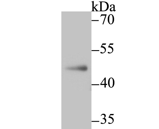 a01521 1 nr0b1 primary antiboties wb testing 1
