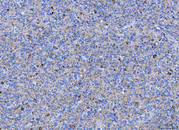  IHC analysis of LC3B/MAP1LC3B using anti-LC3B/MAP1LC3B antibody (A01524-2)