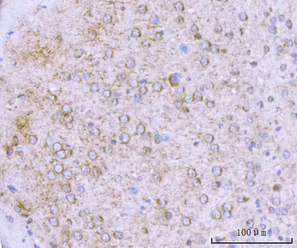  IHC analysis of LC3B/MAP1LC3B using anti-LC3B/MAP1LC3B antibody (A01524-2)
