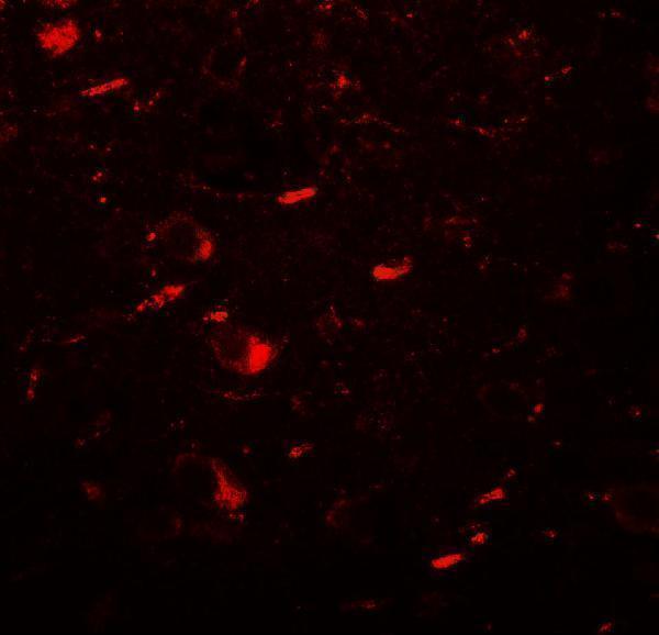 Immunofluorescence of MAP1LC3B in human brain tissue with MAP1LC3B antibody at 20 μg/mL