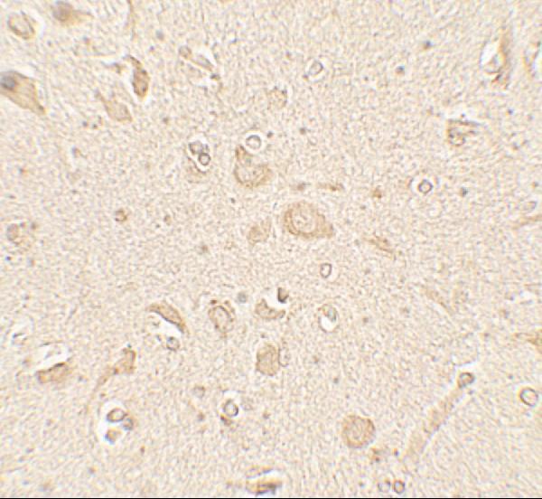 Immunohistochemistry of MAP1LC3B in human brain tissue with MAP1LC3B antibody at 5 μg/mL