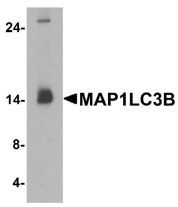 Western blot analysis of MAP1LC3B in human brain tissue lysate with MAP1LC3B antibody at 1 μg/ml