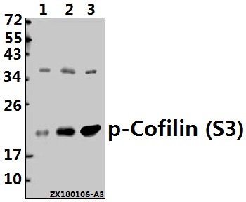 Western blot (WB) analysis of p-Cofilin (S3) pAb at 1:500 dilution
Lane1:SGC7901 whole cell lysate(40ug)
Lane2:HCT116 whole cell lysate(40ug)
Lane3:A549 whole cell lysate(40ug)