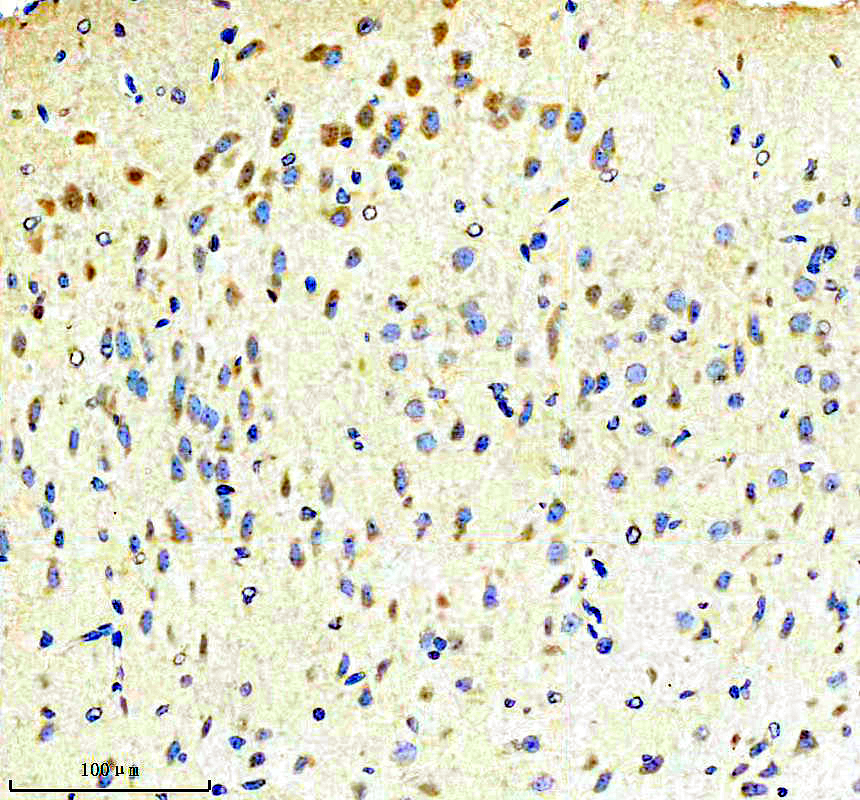 a01529 2 kiaa1199 primary antibodies ihc testing 1