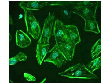 a01530 1 robo1 primary antibodies if testing 4_1