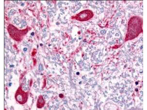 a01530 1 robo1 primary antibodies ihc testing 1_1