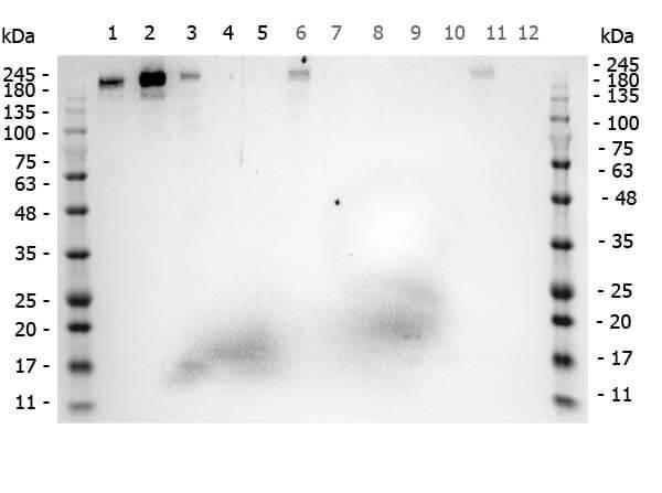 Western Blot of Rabbit anti-ROBO1 antibody