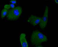 ICC staining RON in A549 cells (green)