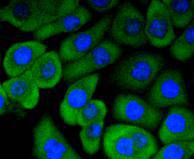 ICC staining RON in AGS cells (green)