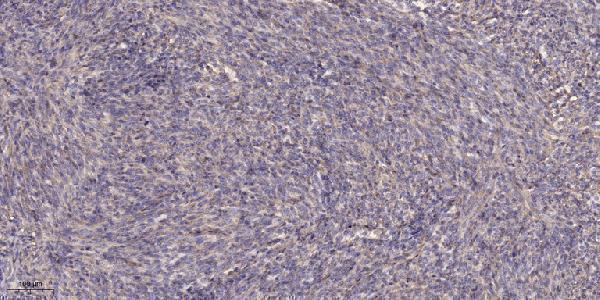 a01532s1394 1 mst1r primary antibodies ihc testing 3