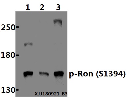 a01532s1394 mst1r primary antiboties wb testing 1