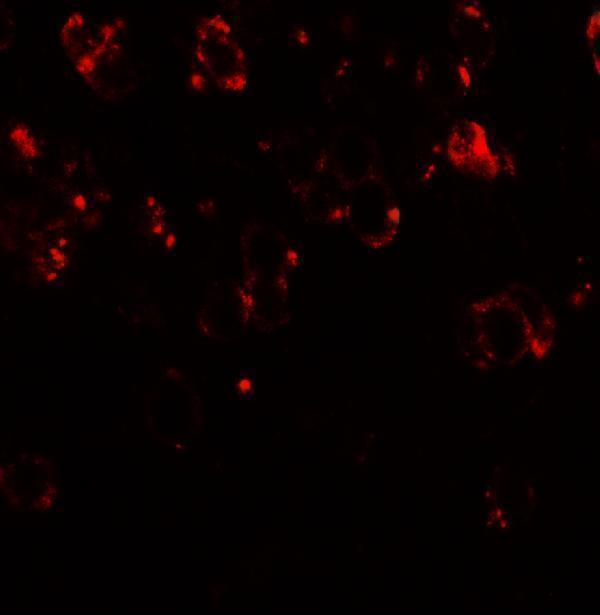 Immunofluorescence of CHD7 in mouse brain tissue with CHD7 antibody at 20 μg/mL