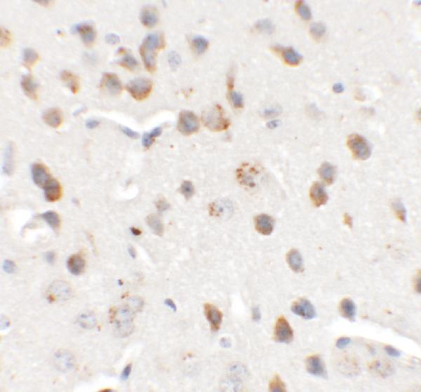 Immunohistochemistry of CHD7 in mouse brain tissue with CHD7 antibody at 5 μg/mL