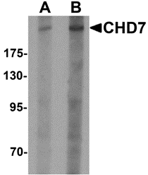 Western blot analysis of CHD7 in SK-N-SH cell lysate with CHD7 antibody at (A) 1 and (B) 2 μg/mL