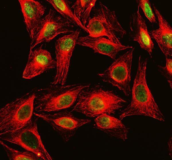 a01535 2 dkc1 primary antibodies if testing 5
